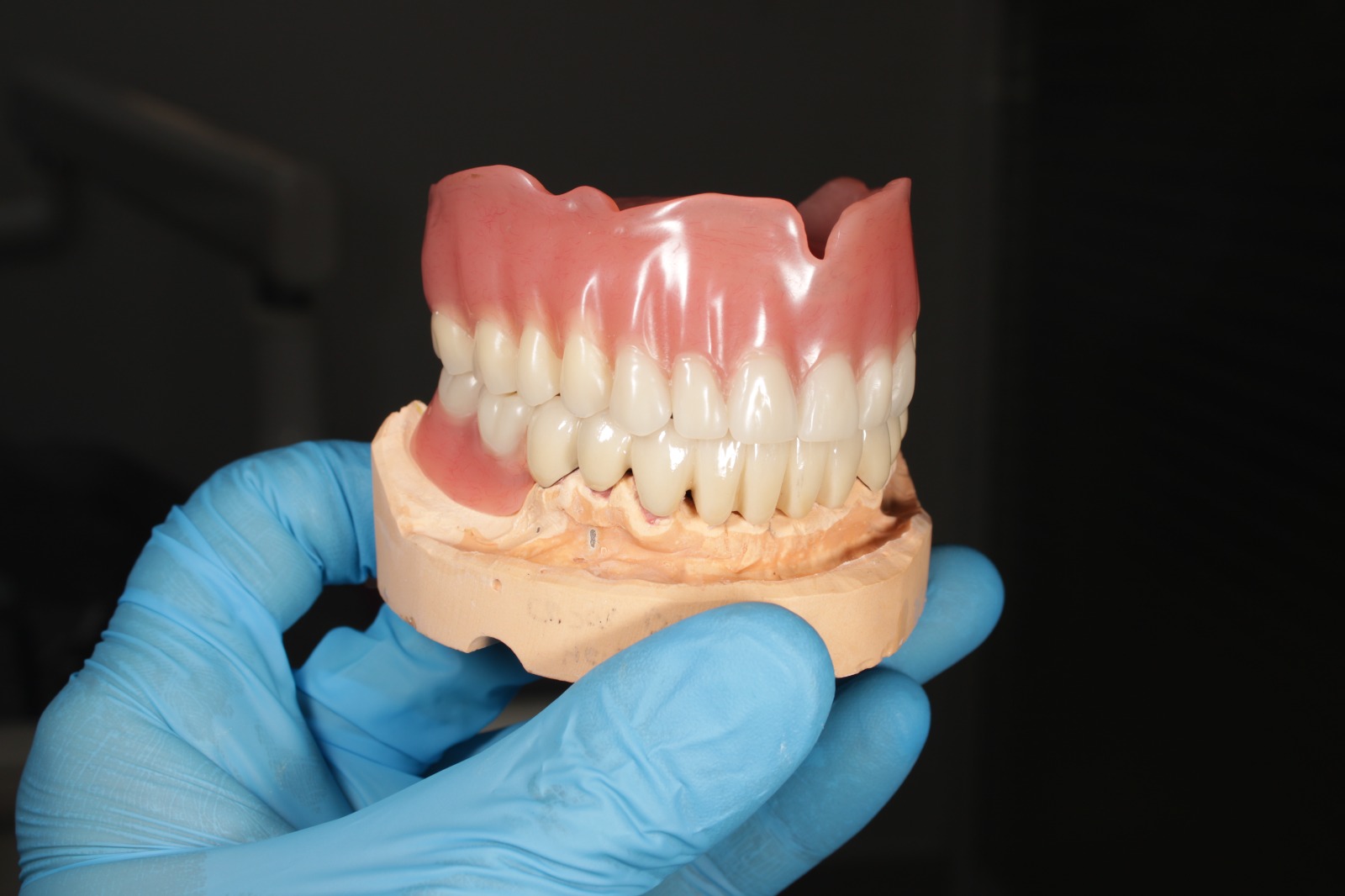 Prótesis Dental Total
